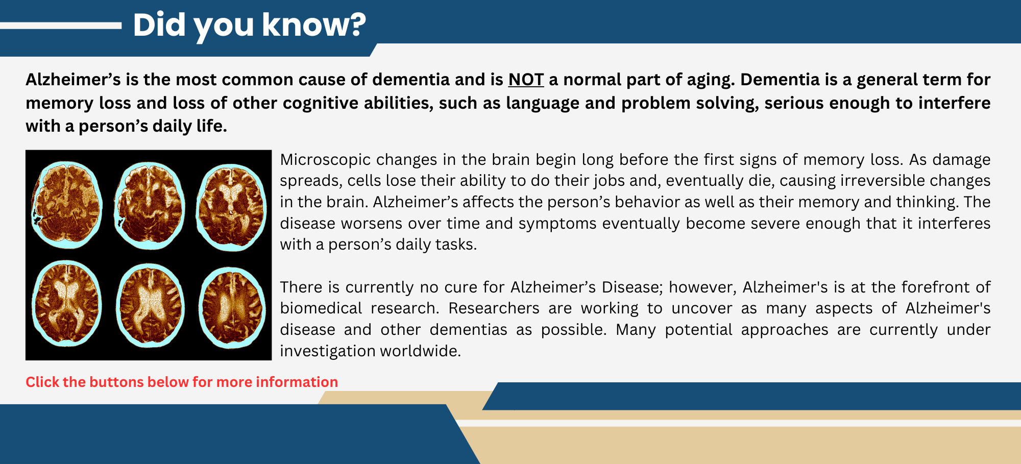 What is Alzheimers and Dementia 2