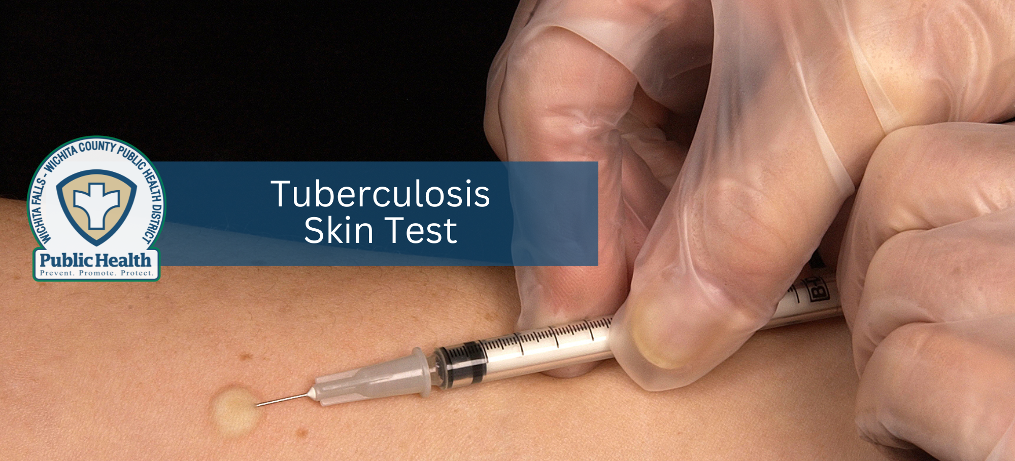 Copy of Subpage_TB Skin Test